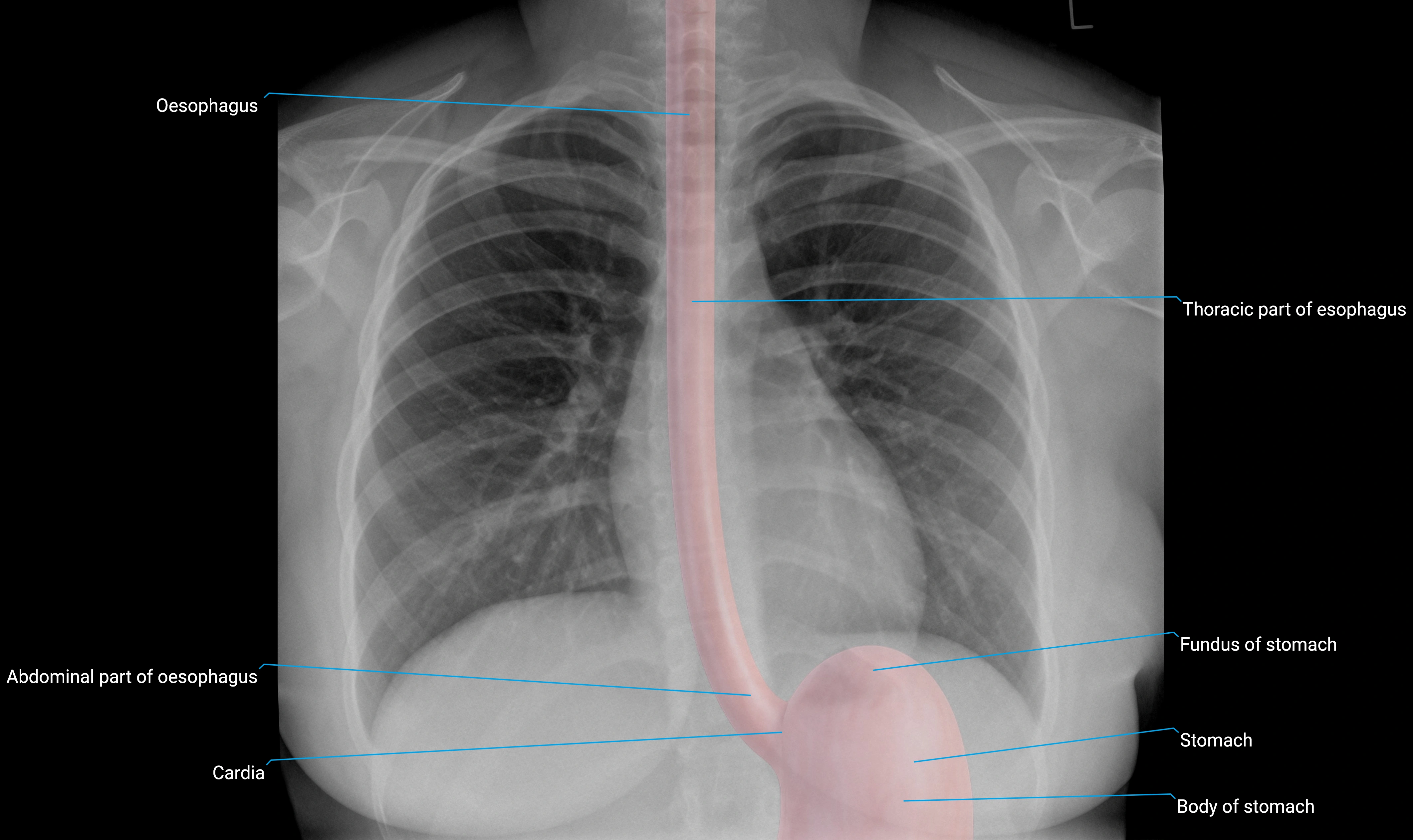 x ray chest oesophagus and stomach anatomy.webp